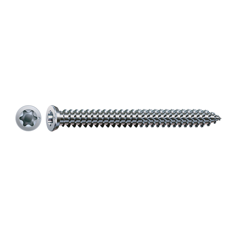 Spax-RA WIROX Countersunk T-Star Plus T30 Frame Anchor 7.5mm x 80mm